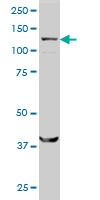 SMC6L1 monoclonal antibody (M01), clone 2E6 Western blot of SMC6L1 expression in HeLa.