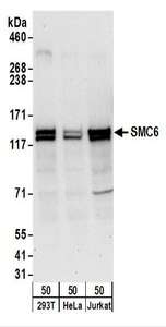 Detection of Human SMC6 by Western Blot. Samples: Whole cell lysate (50 ug) from 293T, HeLa, and Jurkat cells. Antibodies: Affinity purified rabbit anti-SMC6 antibody used for WB at 1 ug/ml. Detection: Chemiluminescence with an exposure time of 3 minutes.