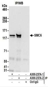 Detection of Human SMC6 by Western Blot of Immunoprecipitates. Samples: Whole cell lysate (1 mg for IP; 20% of IP loaded) from 293T cells. Antibodies: Affinity purified rabbit anti-SMC6 antibody used for IP at 6 ug/mg lysate. SMC6 was also immunoprecipitated by a previous lot (-1) of this antibody. For blotting immunoprecipitated SMC6, was used at 1 ug/ml. Detection: Chemiluminescence with an exposure time of 3 minutes.