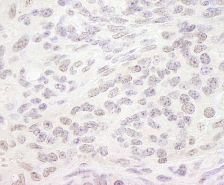 Detection of Mouse PPP4R3 Alpha by Immunohistochemistry. Sample: FFPE section of mouse teratoma. Antibody: Affinity purified rabbit anti-PPP4R3 Alpha used at a dilution of 1:250. Epitope Retrieval Buffer-High pH (IHC-101J) was substituted for Epitope Retrieval Buffer-Reduced pH.