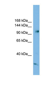 SMEK1 antibody LS-C116734 Western blot of HeLa lysate.
