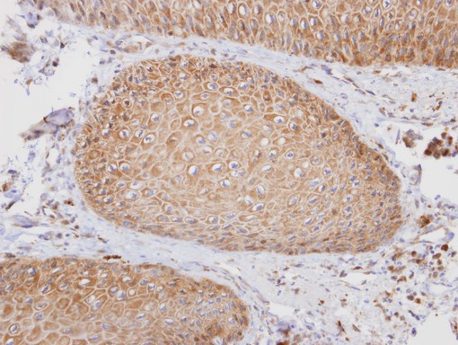 IHC of paraffin-embedded normal oral using PTGFRN antibody at 1:100 dilution.