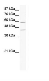 Jurkat Cell Lysate