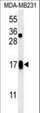 C4orf34 Antibody western blot of MDA-MB231 cell line lysates (35 ug/lane). The C4orf34 antibody detected the C4orf34 protein (arrow).