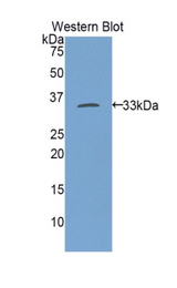 Western blot of recombinant SMMHC / MYH11.