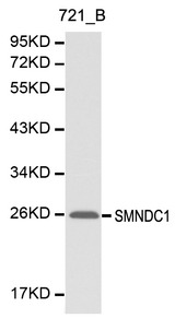 Western blot of SMNDC1 pAb in extracts from 721_B cells.