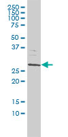 SMNDC1 monoclonal antibody (M01), clone 2B9 Western blot of SMNDC1 expression in Jurkat.