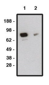 Western blot of SMO antibody (LS-C140596P) on human brain lysate. Lysate loaded at 15 ug/lane. Antibody used at 10 ug/ml (1) and 5 ug/ml (2) dilution. Secondary antibody, mouse anti-rabbit-HRP, used at 1:150K dilution.