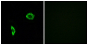 Immunofluorescence of LOVO cells, using Prostacyclin Receptor Antibody. The picture on the right is treated with the synthesized peptide.
