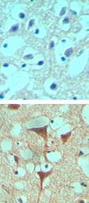 IHC of SMOH in formalin-fixed paraffin-embedded human brain tissue using an isotype control (top) and LS-C47301 (bottom) at 10 ug/ml.