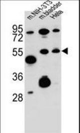 SMOC1 Antibody western blot of mouse NIH-3T3 cell line and mouse bladder tissue and HeLa cell line lysates (35 ug/lane). The SMOC1 antibody detected the SMOC1 protein (arrow).