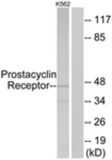 Western blot of extracts from K562 cells, using Prostacyclin Receptor Antibody. The lane on the right is treated with the synthesized peptide.