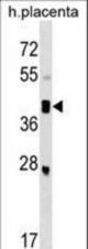 SMOC2 Antibody western blot of human placenta tissue lysates (35 ug/lane). The SMOC2 antibody detected the SMOC2 protein (arrow).