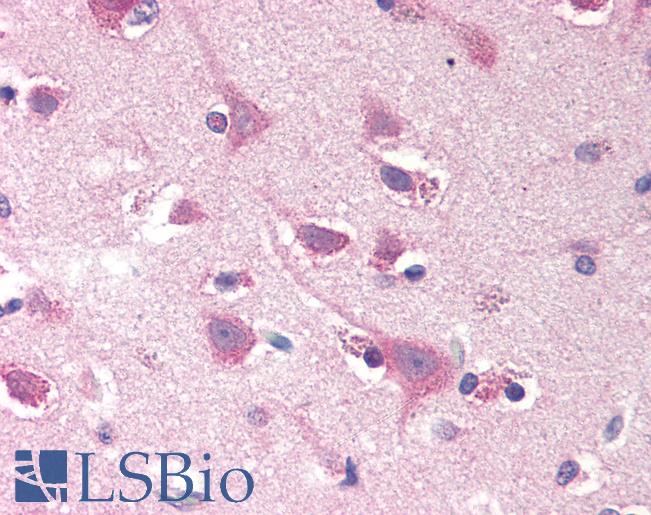 Anti-SMOC2 antibody IHC of human brain, cortex. Immunohistochemistry of formalin-fixed, paraffin-embedded tissue after heat-induced antigen retrieval. Antibody LS-B1839 concentration 20 ug/ml.