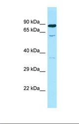 Western blot of Human Fetal Kidney. SMOX antibody dilution 1.0 ug/ml.