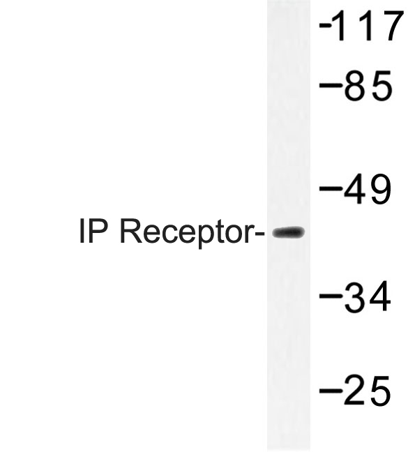 Western blot of IP Receptor (H237) pAb in extracts from K562 cells.
