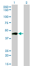 Western blot of PTGIR expression in transfected 293T cell line by PTGIR monoclonal antibody (M01), clone 4B10.