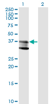 Western Blot analysis of SMPD1 expression in transfected 293T cell line by SMPD1 monoclonal antibody (M01), clone 4H2.Lane 1: SMPD1 transfected lysate(39.6 KDa).Lane 2: Non-transfected lysate.