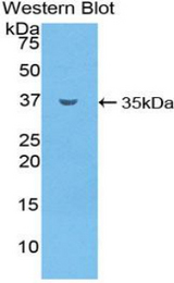 Western blot of recombinant SMPD1 / Acid Sphingomyelinase.
