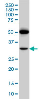 PTGIR monoclonal antibody (M01), clone 4B10 Western blot of PTGIR expression in A-549.