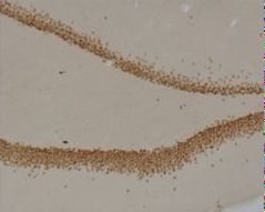 IHC of rat dentate gyrus showing specific immunolabeling of the prox1 protein. Photo courtesy of Justin Kievits and Teresa Milner, Weill Cornell Medical College.