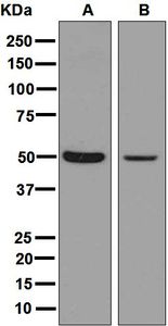 Western blot analysis on (A) mouse brain and (B) rat brain lysates using anti-SMPD2 antibody.