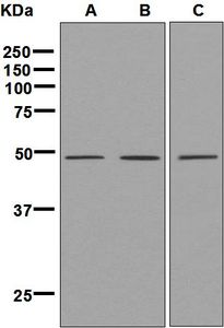Western blot analysis on (A) 293T, (B) Molt-4, and (C) K562 cell lysates using anti-SMPD2 antibody.