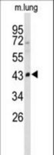 Western blot of SMPD2 Antibody in mouse lung tissue lysates (35 ug/lane). SMPD2 (arrow) was detected using the purified antibody.