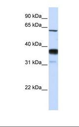 Fetal lung lysate. Antibody concentration: 1.0 ug/ml. Gel concentration: 12%.
