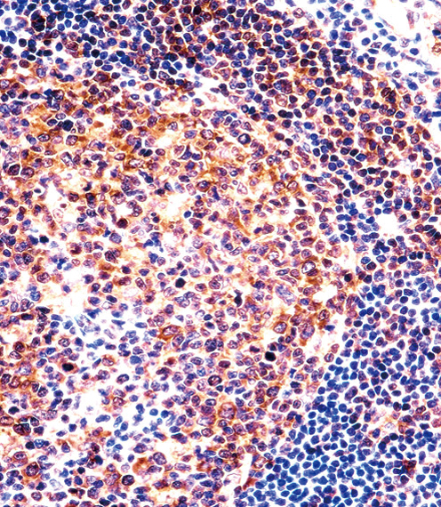 PTGIR Antibody immunohistochemistry of formalin-fixed and paraffin-embedded human tonsil tissue followed by peroxidase-conjugated secondary antibody and DAB staining.