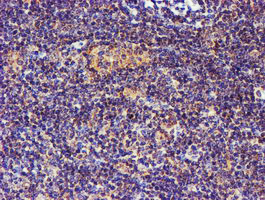 IHC of paraffin-embedded Human lymphoma tissue using anti-SMS mouse monoclonal antibody.