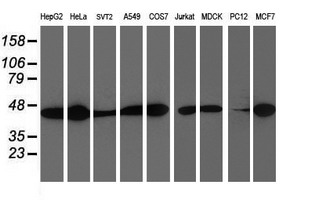 Western blot of extracts (35 ug) from 9 different cell lines by using anti-SMS monoclonal antibody.