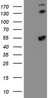 HEK293T cells were transfected with the pCMV6-ENTRY control (Left lane) or pCMV6-ENTRY SMS (Right lane) cDNA for 48 hrs and lysed. Equivalent amounts of cell lysates (5 ug per lane) were separated by SDS-PAGE and immunoblotted with anti-SMS.
