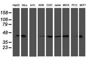 Western blot of extracts (35 ug) from 9 different cell lines by using anti-SMS monoclonal antibody.