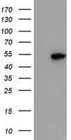 HEK293T cells were transfected with the pCMV6-ENTRY control (Left lane) or pCMV6-ENTRY SMS (Right lane) cDNA for 48 hrs and lysed. Equivalent amounts of cell lysates (5 ug per lane) were separated by SDS-PAGE and immunoblotted with anti-SMS.