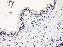 IHC of paraffin-embedded Human prostate tissue using anti-SMS mouse monoclonal antibody.