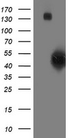HEK293T cells were transfected with the pCMV6-ENTRY control (Left lane) or pCMV6-ENTRY SMS (Right lane) cDNA for 48 hrs and lysed. Equivalent amounts of cell lysates (5 ug per lane) were separated by SDS-PAGE and immunoblotted with anti-SMS.