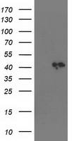 HEK293T cells were transfected with the pCMV6-ENTRY control (Left lane) or pCMV6-ENTRY SMS (Right lane) cDNA for 48 hrs and lysed. Equivalent amounts of cell lysates (5 ug per lane) were separated by SDS-PAGE and immunoblotted with anti-SMS.