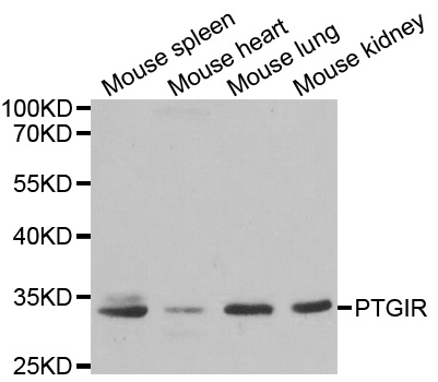 Western blot analysis of extracts of various cell lines, using PTGIR antibody.
