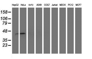 Western blot of extracts (35ug) from 9 different cell lines by using anti-SMS monoclonal antibody.
