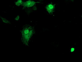 Anti-SMS mouse monoclonal antibody immunofluorescent staining of COS7 cells transiently transfected by pCMV6-ENTRY SMS.