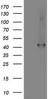 HEK293T cells were transfected with the pCMV6-ENTRY control (Left lane) or pCMV6-ENTRY SMS (Right lane) cDNA for 48 hrs and lysed. Equivalent amounts of cell lysates (5 ug per lane) were separated by SDS-PAGE and immunoblotted with anti-SMS.