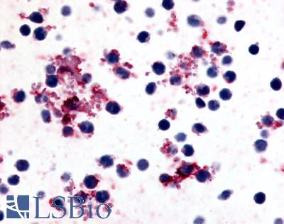 Anti-Prostaglandin I2 Receptor antibody LS-A4395 IHC of human platelets. Immunohistochemistry of formalin-fixed, paraffin-embedded tissue after heat-induced antigen retrieval.