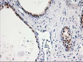 IHC of paraffin-embedded Human prostate tissue using anti-SMS mouse monoclonal antibody.