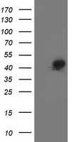 HEK293T cells were transfected with the pCMV6-ENTRY control (Left lane) or pCMV6-ENTRY SMS (Right lane) cDNA for 48 hrs and lysed. Equivalent amounts of cell lysates (5 ug per lane) were separated by SDS-PAGE and immunoblotted with anti-SMS.