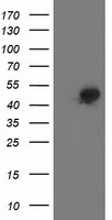 HEK293T cells were transfected with the pCMV6-ENTRY control (Left lane) or pCMV6-ENTRY SMS (Right lane) cDNA for 48 hrs and lysed. Equivalent amounts of cell lysates (5 ug per lane) were separated by SDS-PAGE and immunoblotted with anti-SMS.
