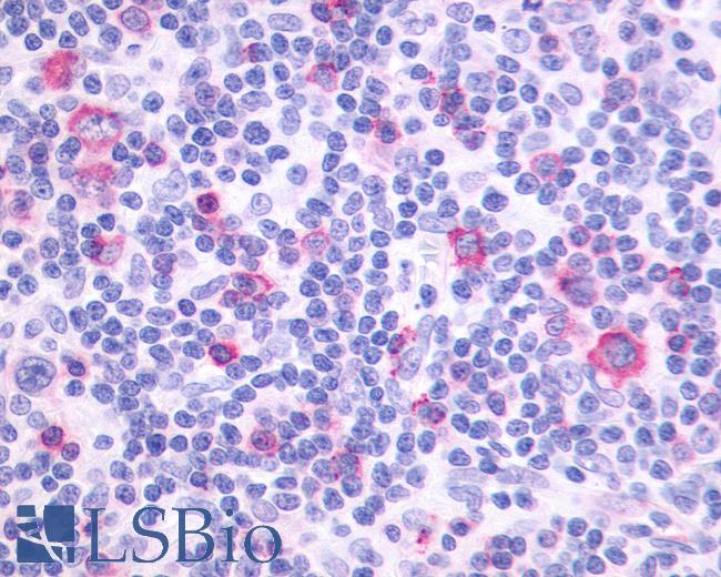 Anti-PTGIR / IP Receptor antibody IHC of human Lymph Node, Hodgkins Lymphoma. Immunohistochemistry of formalin-fixed, paraffin-embedded tissue after heat-induced antigen retrieval.