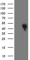 HEK293T cells were transfected with the pCMV6-ENTRY control (Left lane) or pCMV6-ENTRY SMS (Right lane) cDNA for 48 hrs and lysed. Equivalent amounts of cell lysates (5 ug per lane) were separated by SDS-PAGE and immunoblotted with anti-SMS.