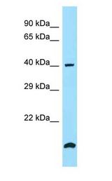 SMS / Spermine Synthase antibody Western Blot of MCF7.
