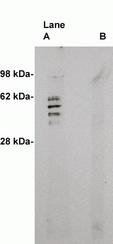 Western blot on human brain lysate (10 ug/lane) using X2059P antibody to Sphingomyelin Synthase 2 (0.5 ug/ml). Lane A] 1 ug/ml antibody alone, lane B] antibody plus 3 ug blocking peptide. Blot was developed with Pierce Super System West Femto - 1 minute exposure.
